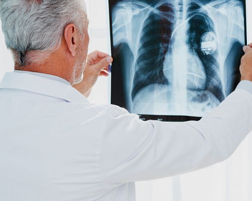 Pneumologia Pneumologia